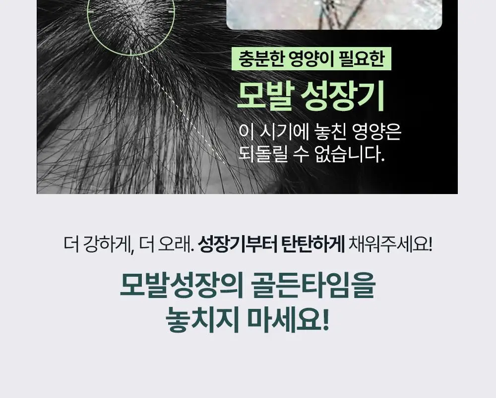 [올영1위 두피앰플] 민트리 스칼프 세럼 20ml 상세페이지 4